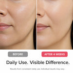 Before-and-after skin comparison of a woman's lower face, showing smoother, more radiant skin after 4 weeks of daily use. The top half is labeled 'BEFORE' and the bottom half is labeled 'AFTER 4 WEEKS' with the text 'Daily Use.