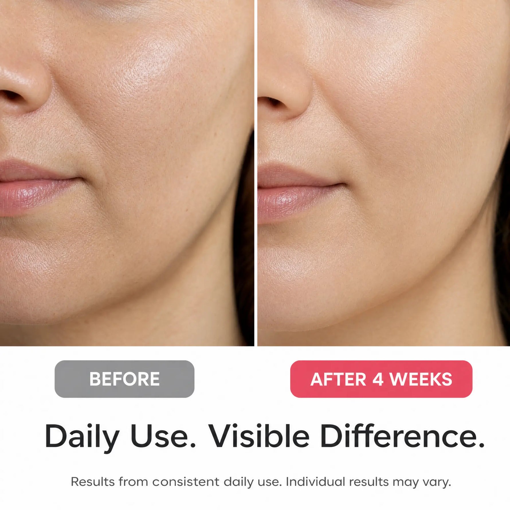 Before-and-after skin comparison of a woman's lower face, showing smoother, more radiant skin after 4 weeks of daily use. The top half is labeled 'BEFORE' and the bottom half is labeled 'AFTER 4 WEEKS' with the text 'Daily Use.